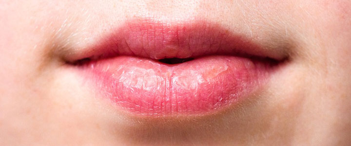 Tus labios se resecan mucho con el frío? 🥶 ¡No te preocupes